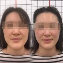 송림프라자타운 | 사천피부관리 받아본 찐후기 브이라인 성공기(보담뷰티)