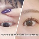 온더래쉬