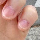 예체로(2-1) | 청주 사창동네일샵 유지력 좋은 니드네일, 물어뜯는 손톱교정 내돈내산