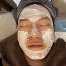 최재영한의원 | 수원여드름한의원 여드름치료/여드름흉터치료 받고 온 후기