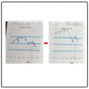 온기담은 한의원 | 돌발성 난청 치료법? 2년간 회복 없던 40대 환자 단기 회복 사례