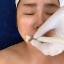 광주 학동 피부관리 윤곽관리 잘하는 아레떼뷰티랩(더블업셀럽리프팅)후기