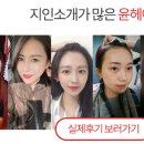 윤헤어라인의원 이미지