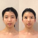 대우세탁박사 | 웨딩 관리 이중턱마사지 추천, 청담에스테틱 '위뷰티 청담점' 방문 후기