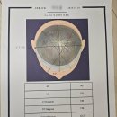 서울웰빙의원 | 9개월 아기 포포, 오쏘 코리아 두상 헬멧 3개월 반 착용 후기 (사두/단두 병원 투어 &amp; STARband 선택 이유)