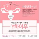 쉬즈산부인과 네이버블로그