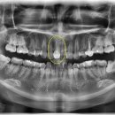 이라인치과기공소 이미지