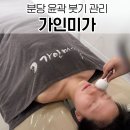 미금경락 또렷한 얼굴 붓기관리 가인미가 분당 본점