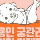 궁에스테틱