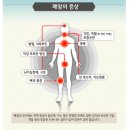 한국인에게 흔한 암 ＜폐암＞ - 국가암정보센터 이미지