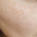 링클스탑의원 이미지