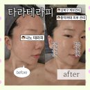 스포웰짐 월곡점 | 동덕여대 피부관리 타라테라피｜나노테라피 받고 피부결 달라진 후기