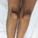 본큐어한의원 이미지