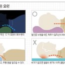 올바른 베개 사용법 이미지