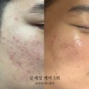 숨앤쉼에스테틱
