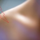 장형석한의원 이미지