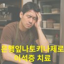 [공지] 재발 막는 이석증 치료 후기 은행잎나토키나제