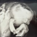 참여성병원 이미지