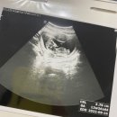 정곡보건지소 | [임신 12주 차, 16주 차] 1차 기형아 검사, 2차 기형아 검사 + 취약 X 증후군 선별검사 후기 :D
