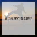 산본나란이치과의원 | 내 치아 건강, 산본역 치과에서 찾았어요! 치석제거 솔직 후기