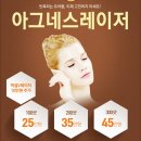 아그네스