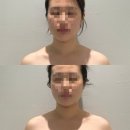 청춘관리 - 전주시 완산구 | 청주윤곽관리 청춘미남 후기