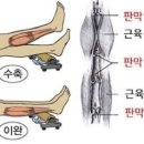 아킬레스