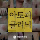 아토피원인 맞추어 아토피피부 체질개선 해보세요