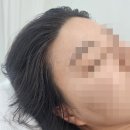 세븐헤어라인 - 함안군 | 청라 슈가링왁싱 저통증으로 안심됐던 헤어라인 앞+이마 최지혜뷰띠끄 솔직후기