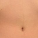 최프로 스킨 앤 바디 이미지