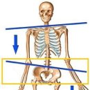 골반교정 필라테스 이미지