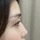 미네네뷰티 | 눈매맞춤 송도속눈썹 유지력 좋은 디자인 속눈썹펌 ‘미네네뷰티’ 추천