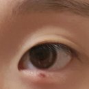 윤안과의원 이미지