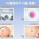 샘여성산부인과의원 네이버블로그