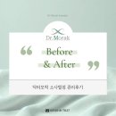 Dr(닥터). 유 안경원 | [공지] 평택탈모 평택두피 닥터모락 소사벌점 남성형 탈모 6개월 관리 후기