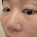 오편한 한의원 | 인계동 메디컬오 한의원 모공리액터 6회차 후기! 수원모공치료 솔직후기