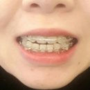 노블치과교정과치과의원 이미지