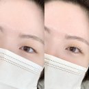 루채뷰티 이미지