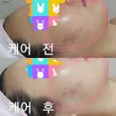 에스케어 이미지