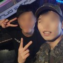 유일교정 치과기공소 | 돌출입 교정 후기 / 군대에서 교정기 쓰면서 생활하고 느낀 점