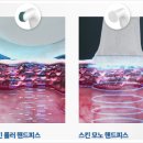 에그멍 이미지