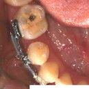 연세중앙치과의원 이미지