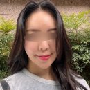 색소침착| 기미치료| 마곡나루피부과 피코슈어토닝 솔직 후기💛