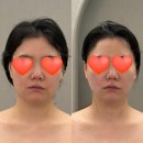 (주)고연 | 파주운정 윤곽관리 |' 고연에스테틱' 웨딩관리, 예신...바로 차이나는 후기 , 파주 운정에스테틱 추천...
