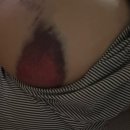 잠실경희한의원 | 📍석촌동 한의원 - 계단에서 구른 나를 살려주셨다,,,,🩵 (ft. 가족같은 병원분들 + 여의사 선생님)