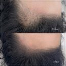 일리즈눈썹&속눈썹펌 이미지