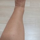 베데스다한의원 | #노바티스성분 #엑스포지 #혈압약을 끊고 한달가량 내가 한일 #평화신경외과 #아로나민골드 #칼슘...