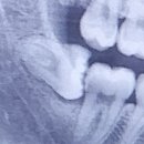 번동현대치과의원 이미지