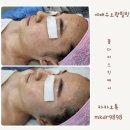 오광케어 네이버블로그
