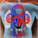 정맥의료기 이미지